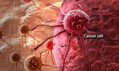 cancer-101-s1-what-is-cancer-cell