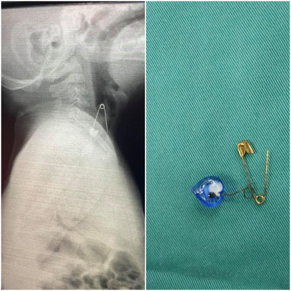 izvadiha-otvorena-bezopasna-igla-263