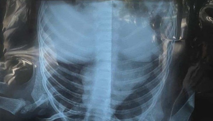 7a337d689a314edbb7e616279b086fc8